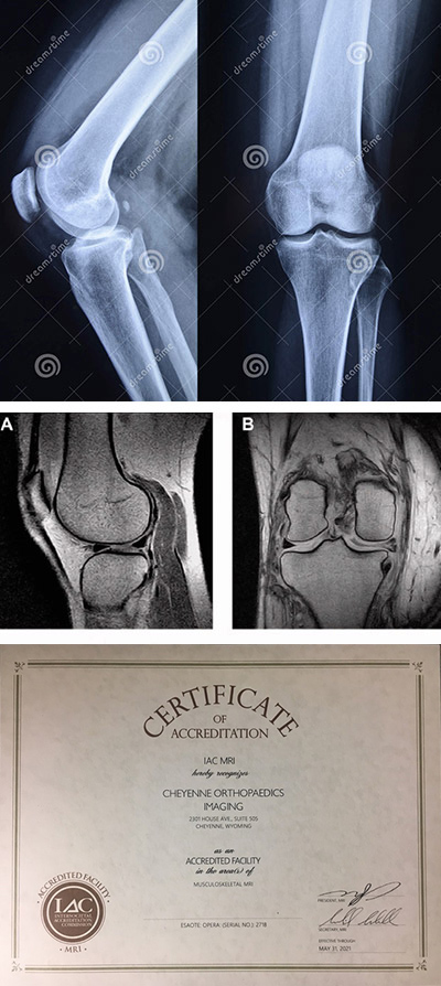 Digital Radiology & Open Extremity MRI